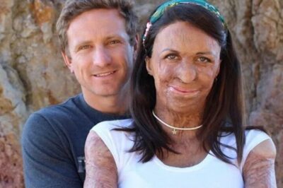 Después de que un incendio dañara la belleza de su esposa, el esposo se niega a abandonarla.
