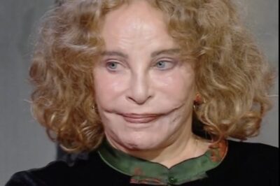 ¡Alguna vez fue llamada la mujer más hermosa del mundo, pero un trágico accidente desfiguró su rostro!