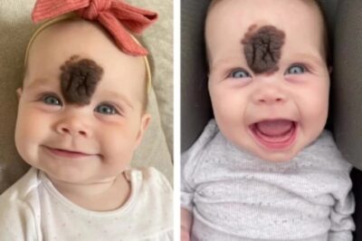 ¡Padres Remueven la Rara Marca de Nacimiento de su Bebé para Protegerla de la Crueldad! ¡Mira Cómo Luce Hoy!