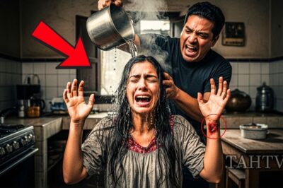 EL ME ARROJÓ AGUA HIRVIENTE EN EL CUERPO… Y ESA CICATRIZ SE CONVIRTIÓ EN MI VENGANZA…