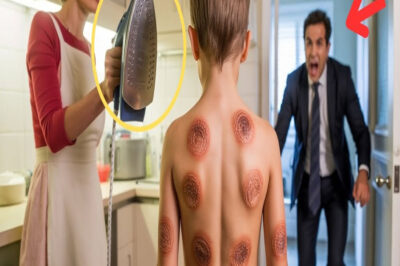 PADRE ENCUENTRA HIJO CON QUEMADURAS DE PLANCHA POR TODO EL CUERPO – MADRASTRA USABA COMO CASTIGO