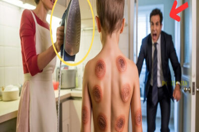 PADRE ENCUENTRA HIJO CON QUEMADURAS DE PLANCHA POR TODO EL CUERPO – MADRASTRA USABA COMO CASTIGO…