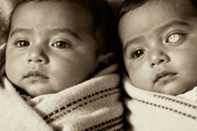 Lucía y Elena: Las Gemelas que Compartieron un Alma | Historia Real