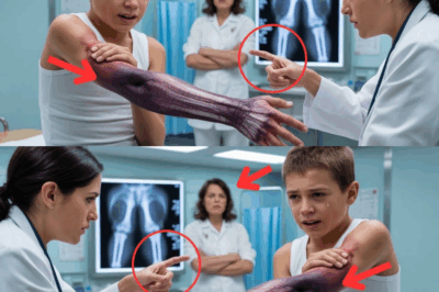 MADRASTRA IGNORA BRAZO ROTO DE NIÑO 30 HORAS DICIENDO “EXAGERAS” CIRUGÍA DE EMERGENCIA SALVA SU MANO